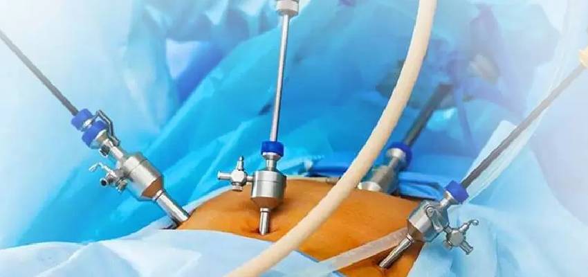Laparoscopic Surgeons in Kandivali